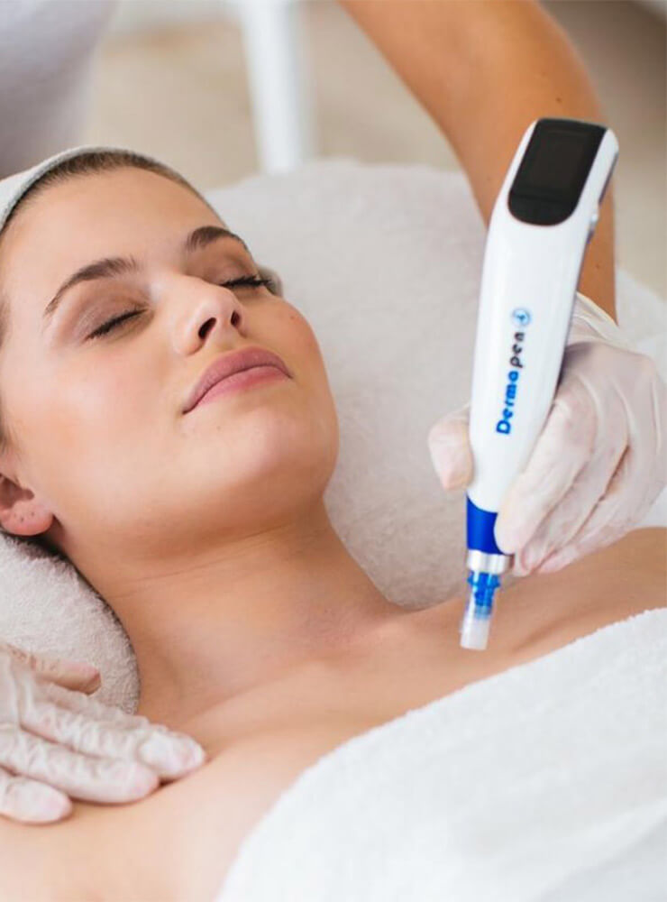 A woman lying back in a beauty salon chair having skin microneedling treatment with a dermapen.